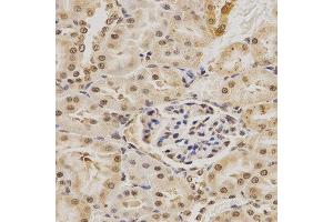 Immunohistochemistry (IHC) image for anti-Mdm2, p53 E3 Ubiquitin Protein Ligase Homolog (Mouse) (MDM2) (AA 130-230) antibody (ABIN3020951)