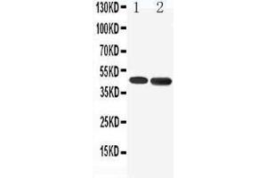 Anti-5HT1A Receptor antibody, Western blotting Lane 1: Rat Brain Tissue Lysate Lane 2: Human U87 Cell Lysate (Serotonin Receptor 1A antibody  (C-Term))