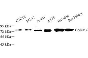 Western blot analysis of GSDMC (ABIN7074590) at dilution of 1: 50 (MLZE antibody)