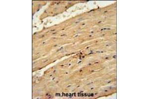 TI Antibody (Center) (ABIN654107 and ABIN2843990) immunohistochemistry analysis in formalin fixed and paraffin embedded mouse heart tissue followed by peroxidase conjugation of the secondary antibody and DAB staining. (TIMP4 antibody  (AA 48-74))