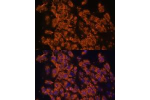 Immunofluorescence analysis of C6 cells using LRRC7 antibody (ABIN6128203, ABIN6143347, ABIN6143348 and ABIN6216986) at dilution of 1:100. (LRRC7 antibody  (AA 730-890))