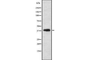 Western blot analysis of TF2A2 using K562 whole cell lysates (GTF2A2 antibody  (Internal Region))