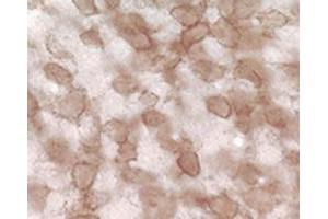 Immunohistochemical staining of pan synuclein in rat cochlear nucleus using Synuclein (pan) polyclonal antibody . (Synuclein antibody)