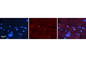 Rabbit Anti-IKZF4 Antibody    Formalin Fixed Paraffin Embedded Tissue: Human Adult heart  Observed Staining: Nuclear Primary Antibody Concentration: 1:100 Secondary Antibody: Donkey anti-Rabbit-Cy2/3 Secondary Antibody Concentration: 1:200 Magnification: 20X Exposure Time: 0. (IKZF4 antibody  (N-Term))