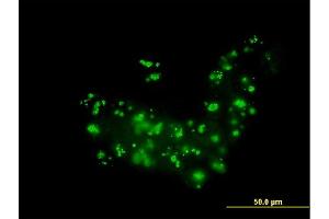 Immunofluorescence of monoclonal antibody to RAB36 on A-431 cell. (RAB36 antibody  (AA 234-333))