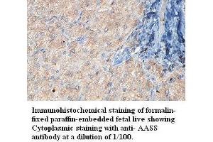 Image no. 1 for anti-Aminoadipate Semialdehyde Synthase (AASS) antibody (ABIN1574369)