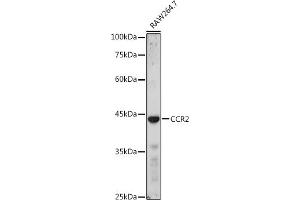 Western blot analysis of extracts of R. (CCR2 antibody  (AA 315-374))