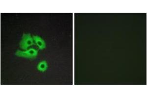 Immunofluorescence analysis of COS7 cells, using CCBP2 Antibody. (CCBP2 antibody  (AA 335-384))