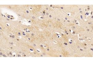 Immunohistochemistry (IHC) image for anti-Fibroblast Growth Factor 2 (Basic) (FGF2) (AA 26-153) antibody (APC) (ABIN7437899)