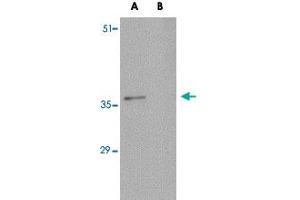 Western blot analysis of C16orf53 in EL4 cell lysate with C16orf53 polyclonal antibody  at 1 ug/mL . (PAGR1 antibody  (C-Term))