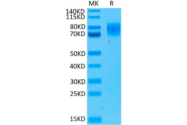 IFNA Protein (His-Avi Tag,Biotin)