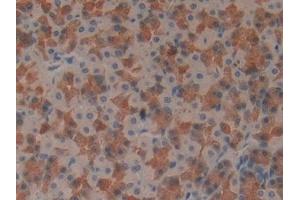 Detection of IFNg in Rat Stomach Tissue using Monoclonal Antibody to Interferon Gamma (IFNg) (Interferon gamma antibody  (AA 23-156))