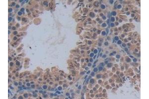 Detection of PFKP in Mouse Testis Tissue using Polyclonal Antibody to Phosphofructokinase, Platelet (PFKP) (PFKP antibody  (AA 247-473))