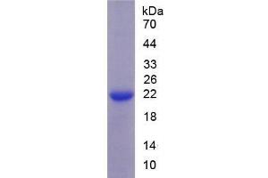 SDS-PAGE (SDS) image for Solute Carrier Family 12 (Sodium/Chloride Transporters), Member 3 (SLC12A3) ELISA Kit (ABIN6720503)
