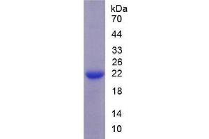 SDS-PAGE of Protein Standard from the Kit (Highly purified E. (SLC12A3 ELISA Kit)