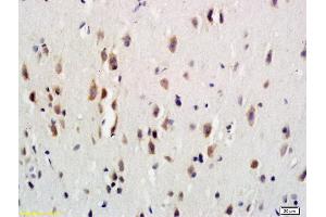 Formalin-fixed and paraffin embedded rat brain labeled with Anti-G-CSFR/CD114 Polyclonal Antibody, Unconjugated (ABIN742275) at 1:600 followed by conjugation to the secondary antibody and DAB staining (CSF3R antibody  (AA 101-200))