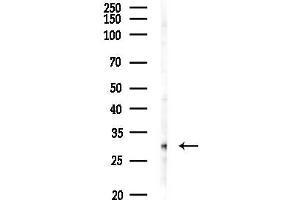 anti-FOS-Like Antigen 2 (FOSL2) (C-Term) antibody
