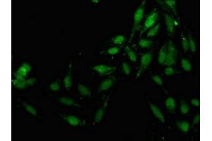 Immunofluorescence staining of Hela cells with ABIN7157162 at 1:133, counter-stained with DAPI. (JMY antibody  (AA 708-848))