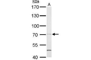 WB Image SHP2 antibody detects PTPN11 protein by Western blot analysis. (PTPN11 antibody  (C-Term))