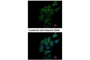 ICC/IF Image Immunofluorescence analysis of methanol-fixed Hep3B, using SIAT4A, antibody at 1:500 dilution.