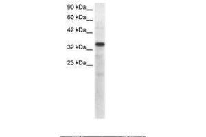 Image no. 1 for anti-T-Box 10 (TBX10) (AA 41-90) antibody (ABIN6735829) (T-Box 10 antibody  (AA 41-90))