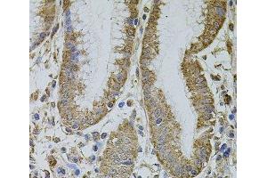 Immunohistochemistry of paraffin-embedded Human stomach using MTIF3 Polyclonal Antibody at dilution of 1:100 (40x lens). (MTIF3 antibody)