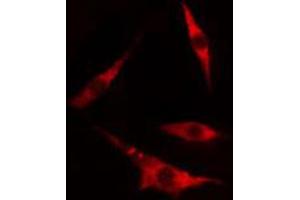 ABIN6274445 staining 293 cells by IF/ICC. (DOK4 antibody  (N-Term))