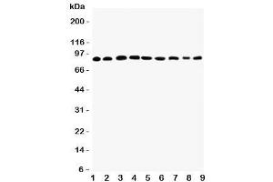 Western blot testing of Plakophilin 2 antibody and Lane 1:  rat heart (Plakophilin 2 antibody  (C-Term))