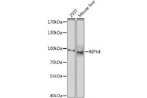Western blot analysis of extracts of various cell lines using RIPK4 Polyclonal Antibody at dilution of 1:1000.