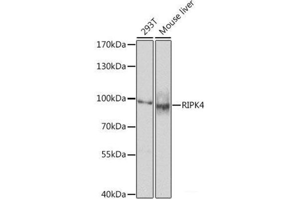 RIPK4 anticorps
