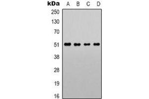 Western blot analysis of Alpha-1A Adrenergic Receptor expression in LOVO (A), Jurkat (B), NIH3T3 (C), PC12 (D) whole cell lysates. (alpha 1 Adrenergic Receptor antibody  (C-Term))