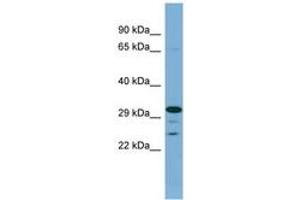 Image no. 1 for anti-Dehydrogenase/reductase (SDR Family) Member 9 (DHRS9) (AA 215-264) antibody (ABIN6741830) (DHRS9 antibody  (AA 215-264))