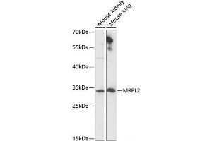 Western blot analysis of extracts of various cell lines using MRPL2 Polyclonal Antibody at dilution of 1:1000. (MRPL2 antibody)