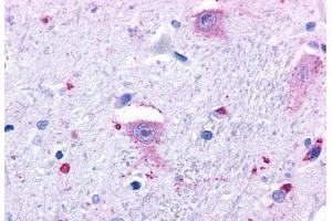 Anti-GPR37 antibody  ABIN1048809 IHC staining of human brain, neurons and glia.