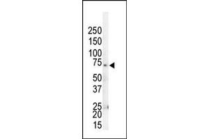 Western blot analysis of anti-GRK4 Pab (ABIN1882085 and ABIN2841170) in HL60 cell lysate. (GRK4 antibody  (C-Term))