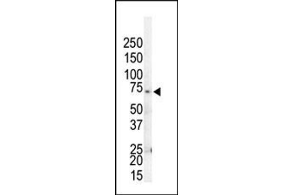 GRK4 antibody  (C-Term)