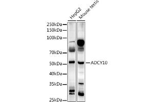 Western blot analysis of extracts of various cell lines, using  antibody (ABIN7265465) at 1:1000 dilution. (ADCY10 antibody)