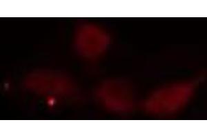 ABIN6275552 staining  Hela cells by IF/ICC.