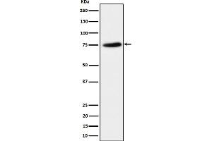 Western blot analysis of PPM1G expression in HeLa cell lysate. (Recombinant PPM1G antibody)