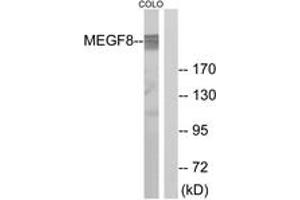 Western Blotting (WB) image for anti-Multiple EGF-Like-Domains 8 (MEGF8) (AA 1243-1292) antibody (ABIN2890423) (MEGF8 antibody  (AA 1243-1292))