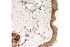Immunohistochemical analysis of Desmoglein 1 staining in human skin formalin fixed paraffin embedded tissue section. (Desmoglein 1 antibody  (N-Term))