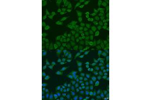 Immunofluorescence analysis of U2OS cells using PLA2G4C antibody (ABIN2737385) at dilution of 1:100. (PLA2G4C antibody)