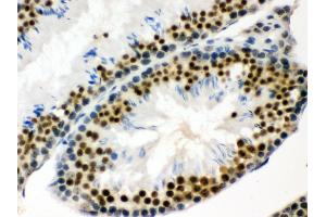 Anti- EWSR1 Picoband antibody, IHC(P) IHC(P): Mouse Testis Tissue (EWSR1 antibody  (Middle Region))
