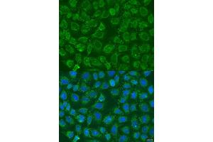 Immunofluorescence analysis of U2OS cells using PIP5K1B antibody (ABIN6130645, ABIN6145684, ABIN6145686 and ABIN6223693) at dilution of 1:100. (PIP5K1B antibody  (AA 190-470))