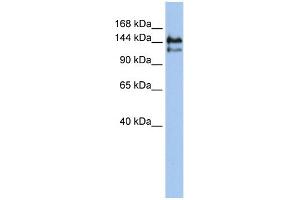 WB Suggested Anti-SUPT5H Antibody Titration:  0. (SUPT5H antibody  (Middle Region))