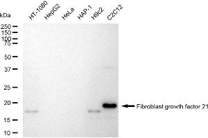 Western blotting analysis using Fibroblast growth factor 21 antibody (ABIN7798606).