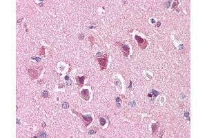 Anti-ENT1 antibody IHC of human brain, cortex.