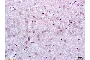 Formalin-fixed and paraffin embedded rat brain tissue labeled with Anti-KDM5B/PLU1/Jarid1B Polyclonal Antibody, Unconjugated (ABIN762986) at 1:200 followed by conjugation to the secondary antibody and DAB staining