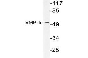 Western blot analysis of BMP-5 Antibody in extracts from HUVEC cells. (BMP5 antibody)