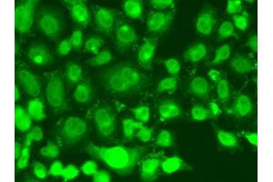 Immunofluorescence analysis of A549 cell using TSEN2 antibody. (TSEN2 antibody)